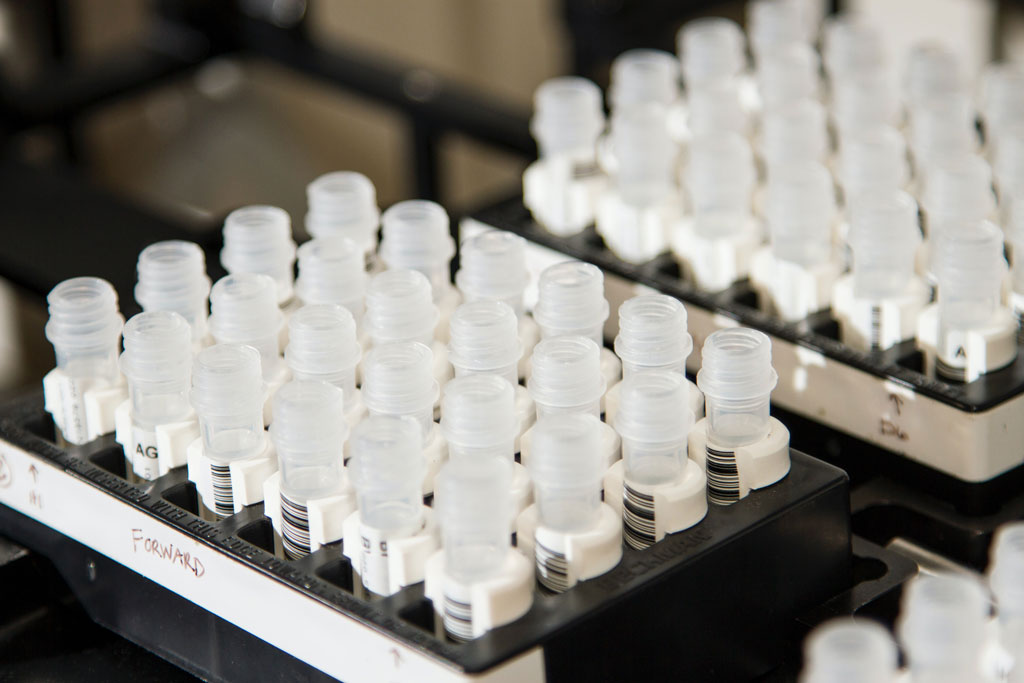 Trays of lab testing tubes